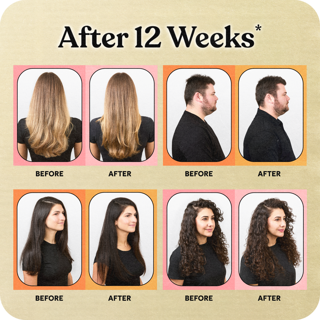 Before and after hair growth results after 12 weeks shown on a beige background.